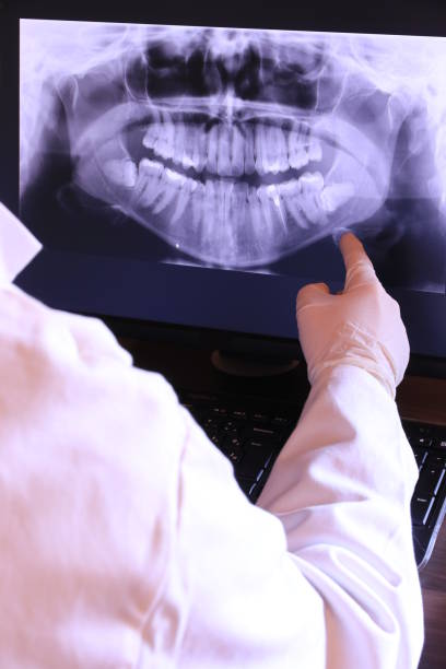 Best Emergency Root Canal Therapy in Cortland West, NY